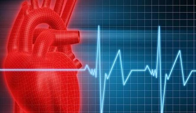 Waspadai Komplikasi Aritmia, atau Gangguan Irama Jantung